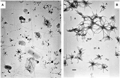 Discovery of High Abundances of Aster-Like Nanoparticles in Pelagic Environments: Characterization and Dynamics